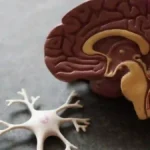 Alzheimer