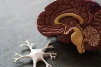 Alzheimer