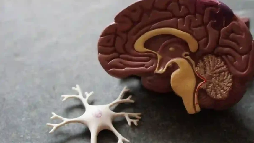 Alzheimer